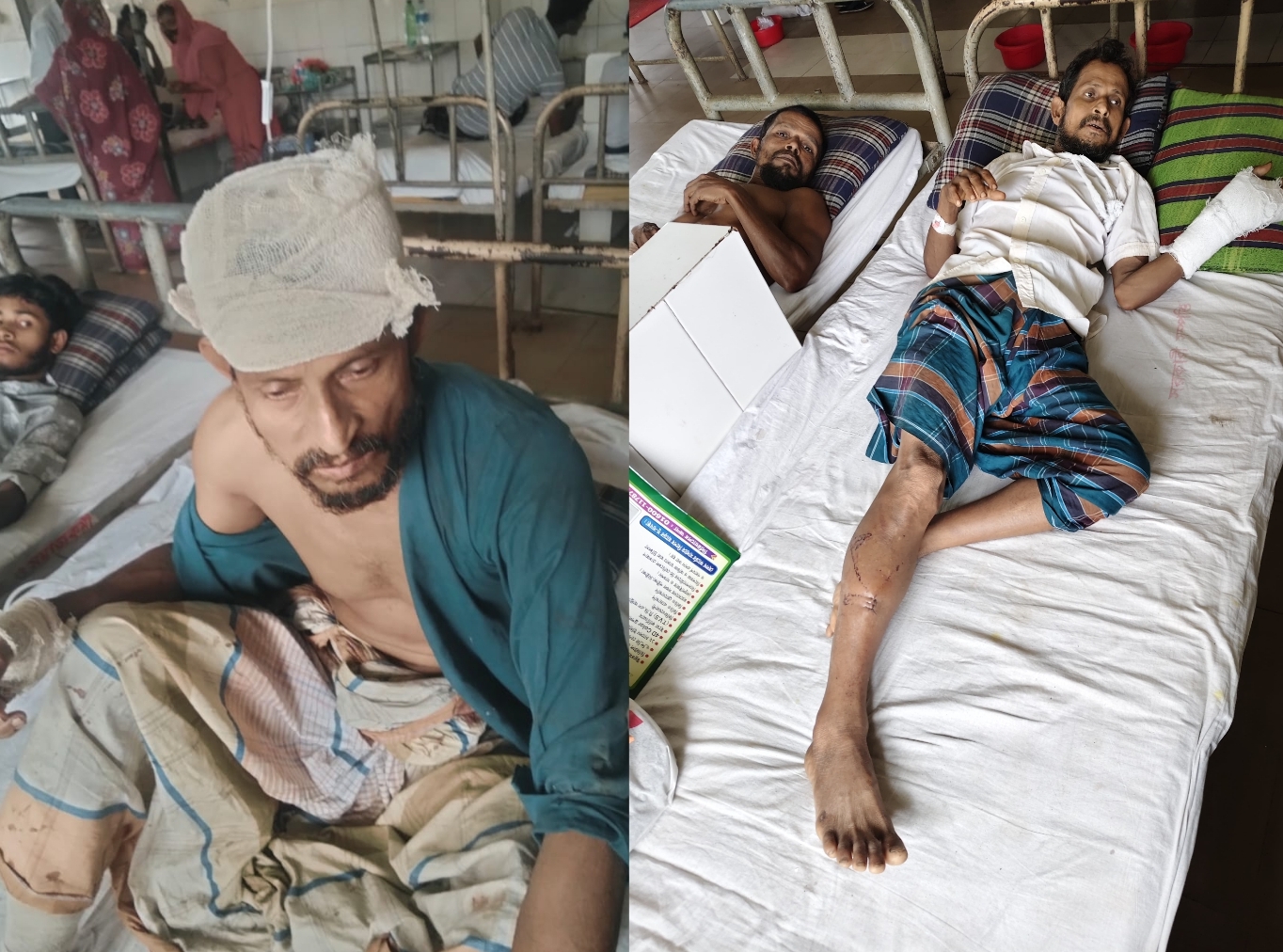 কাপাসিয়ায় জমি নিয়ে বিরোধ: ভাড়াটে সন্ত্রাসী নিয়ে দুই ভাই ও নারীকে কুপিয়ে জখম